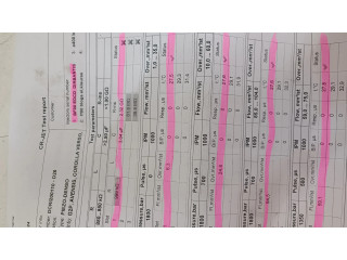 Форсунка DCR1200110, 03E00685    Lexus IS 220D-250-350 для дизельного двигателя  2.2