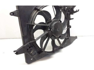 Вентилятор радиатора 8200765566, 3135104018 Dacia Sandero